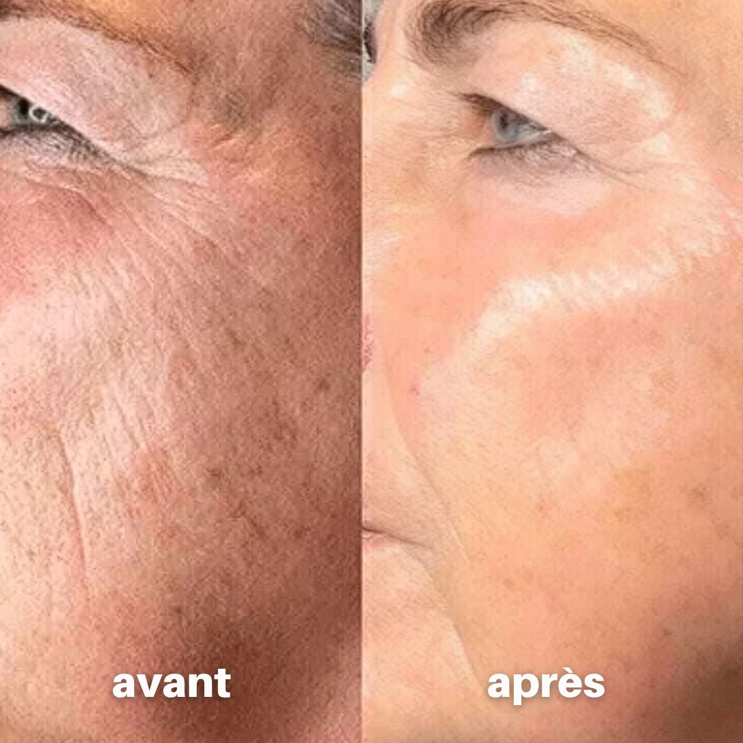 Julie™ • Sérum Anti-âge