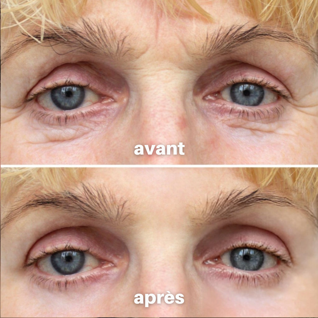 Julie™ • Sérum Anti-âge