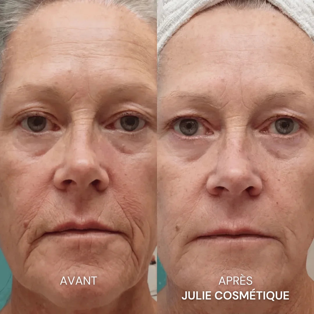 Julie™ • Sérum Anti-âge