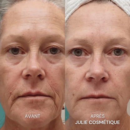 Julie™ • Sérum Anti-âge