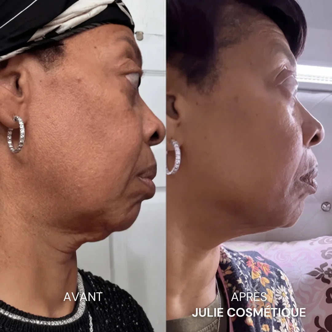 Julie™ • Sérum Anti-âge