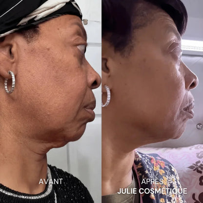Julie™ • Sérum Anti-âge