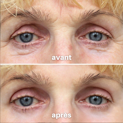 Julie™ • Sérum Anti-âge