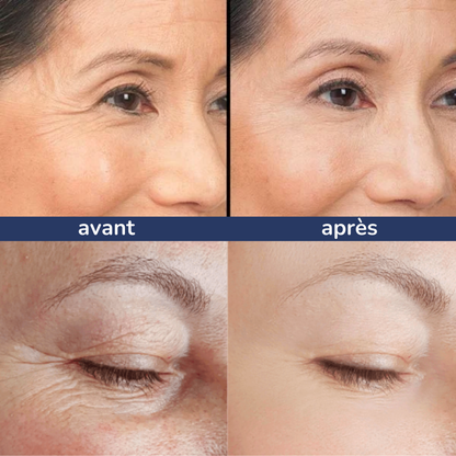 Julie™ • Crème hydratante anti-cernes