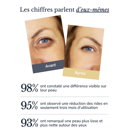 Julie™ • Crème hydratante anti-cernes