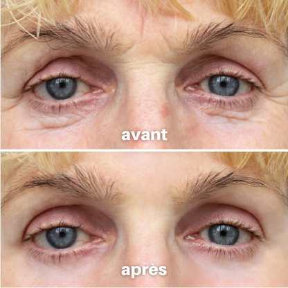 Julie™ • Crème hydratante anti-cernes