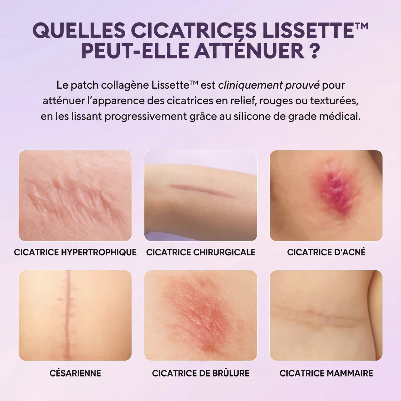 Lissette™ Patchs Collagène en Silicone
