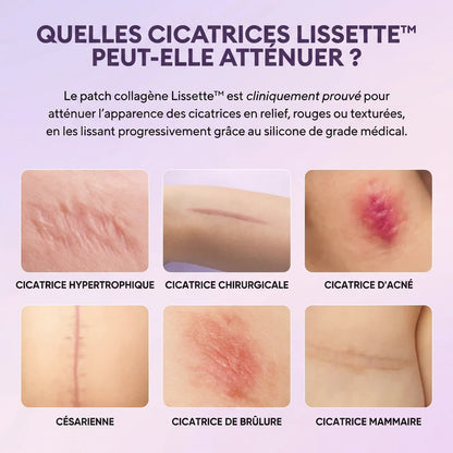 Lissette™ Patchs Collagène en Silicone