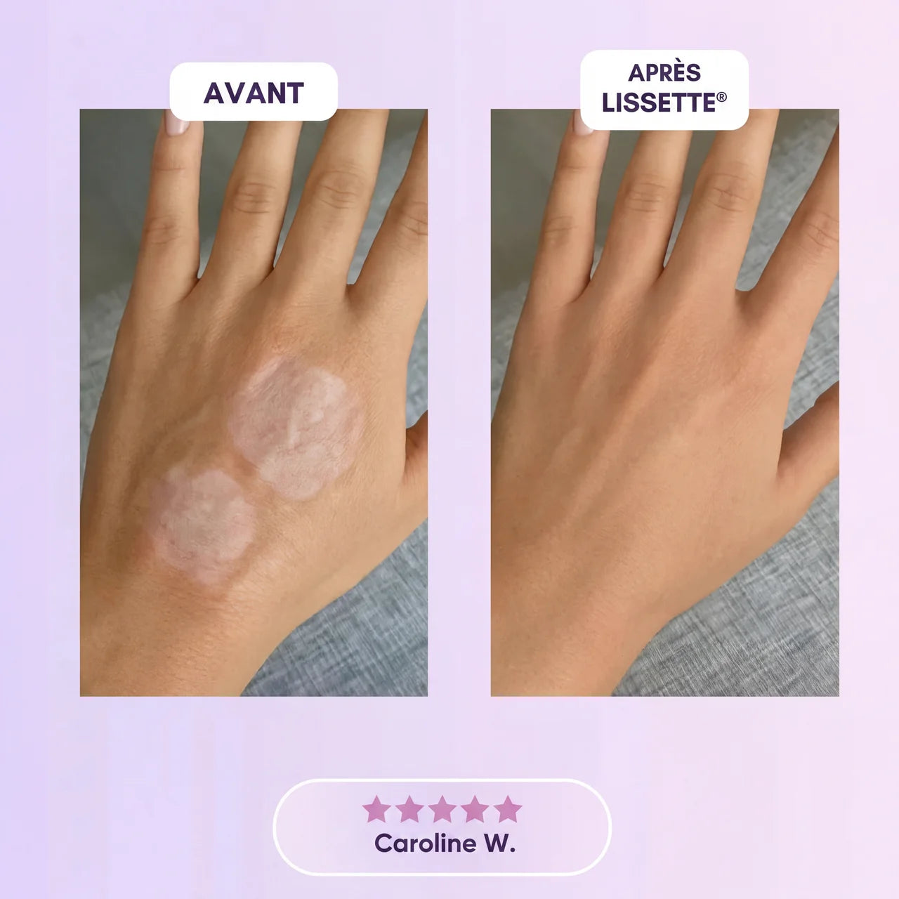 Lissette™ Patchs Collagène en Silicone