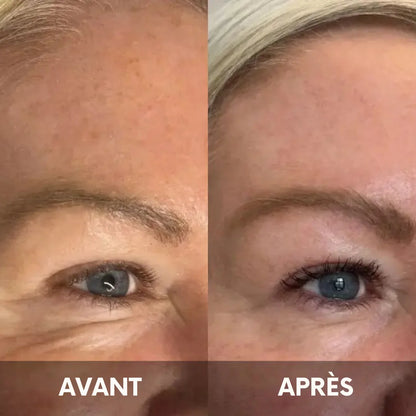 Julie™ • Crème hydratante anti-cernes