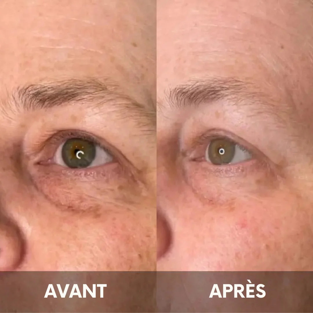 Julie™ • Crème hydratante anti-cernes