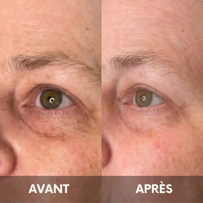 Julie™ • Crème hydratante anti-cernes