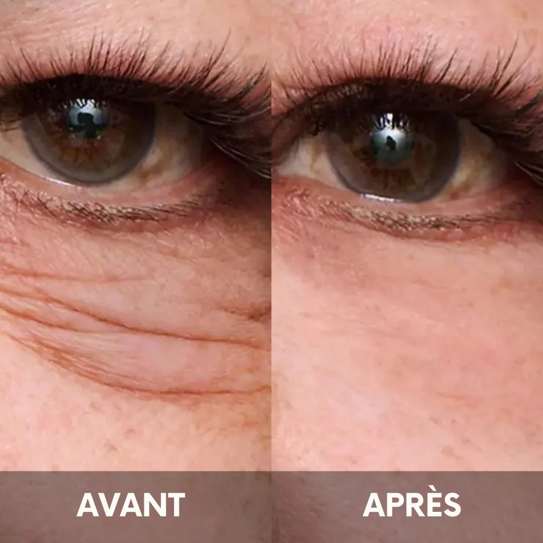 Julie™ • Crème hydratante anti-cernes