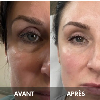 Julie™ • Crème hydratante anti-cernes