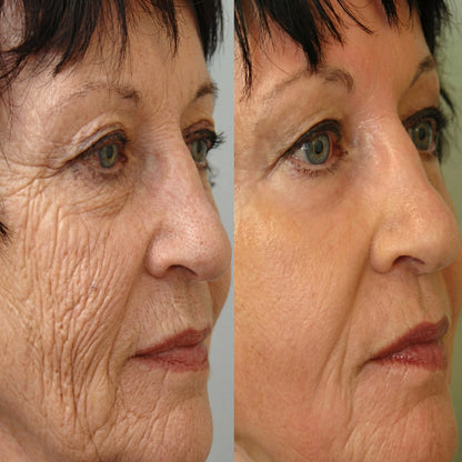 Julie™ • Sérum Anti-âge
